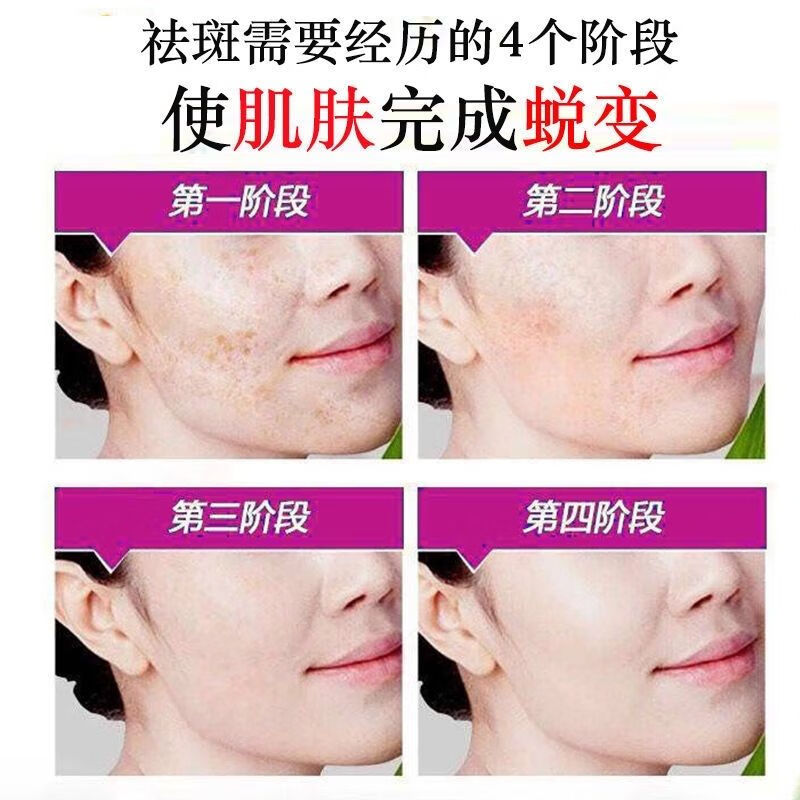 百花佰花方霜强力美白淡化雀斑晒斑去斑周期装2瓶