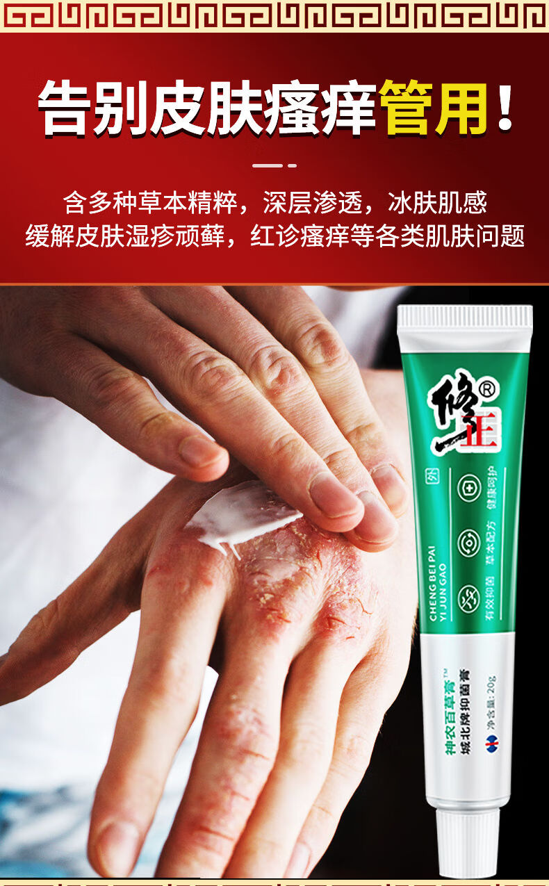修正神农百草膏止痒膏皮肤ii癣痒灵瘙痒皮肤抑菌膏牛皮ii癣脚气湿ii疹
