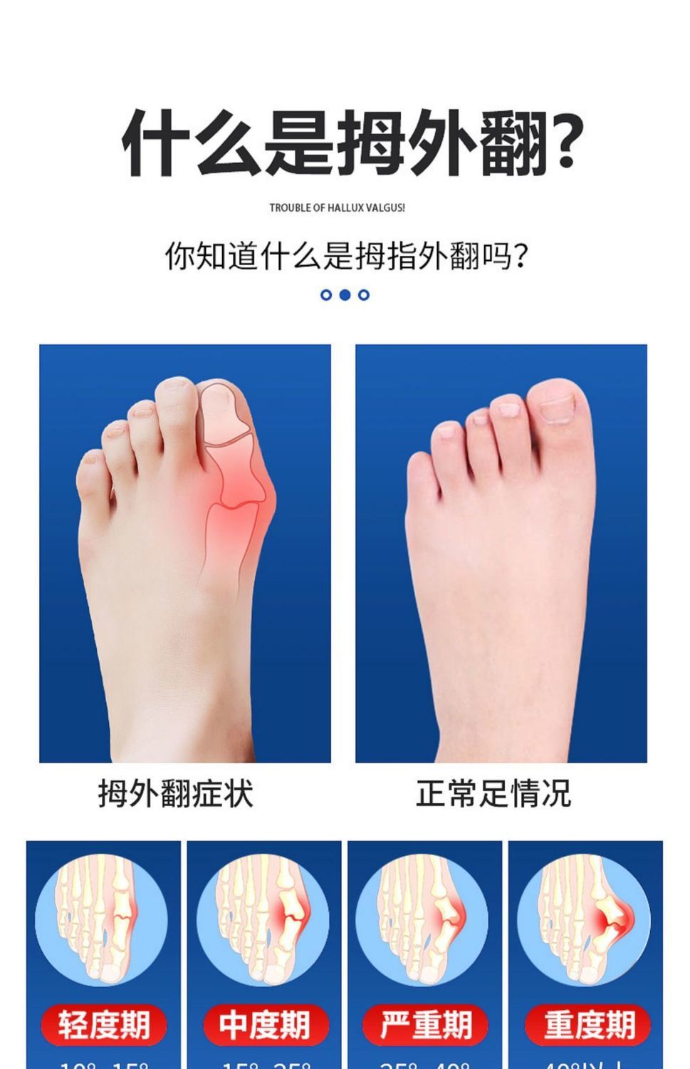 齐茵桐护指拇外翻脚趾器大拇指脚趾重叠纠正大脚骨防磨脚护脚套穿鞋