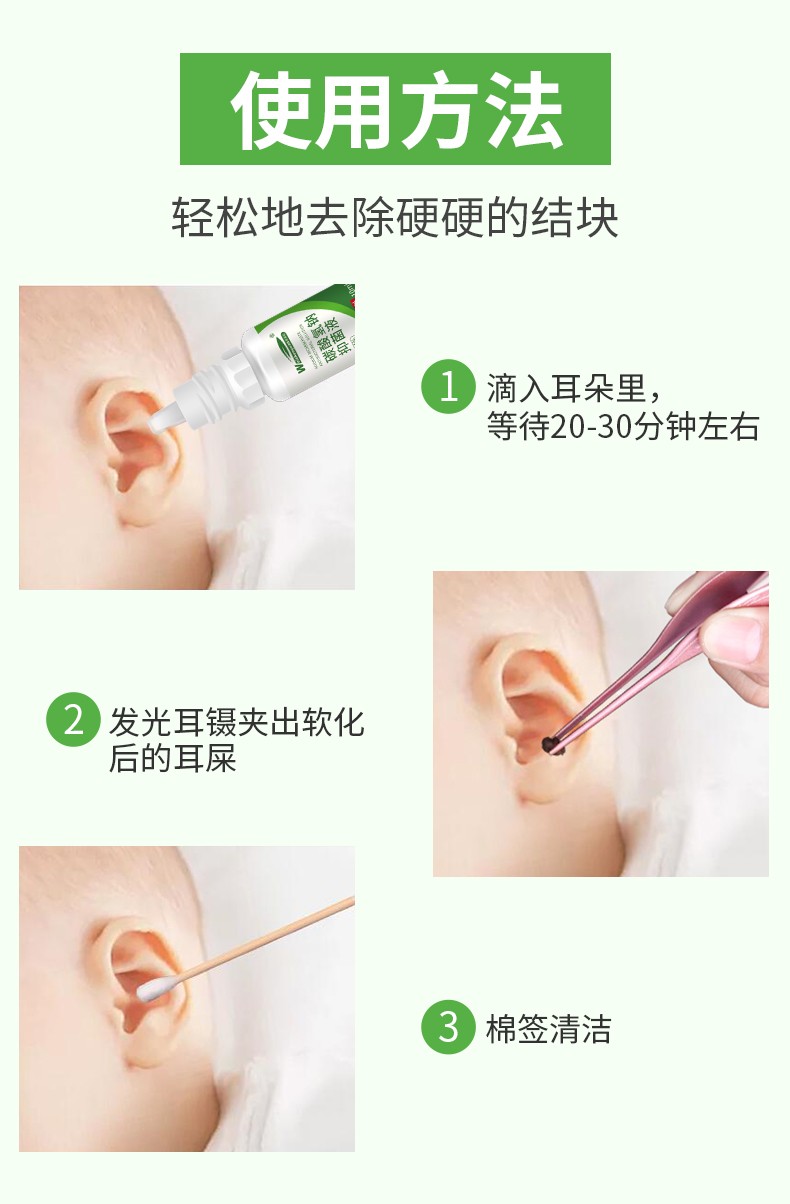 碳酸氢钠滴耳液人用洗耳水耵聍滴耳油儿童耳结石去耳垢耳屎软化剂 1瓶