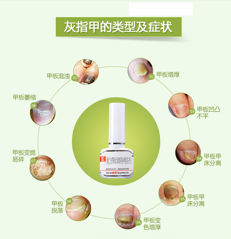 亮甲 复方聚维酮碘搽剂 3ml*2瓶灰指甲液专用药水脚气抗菌感染亮甲