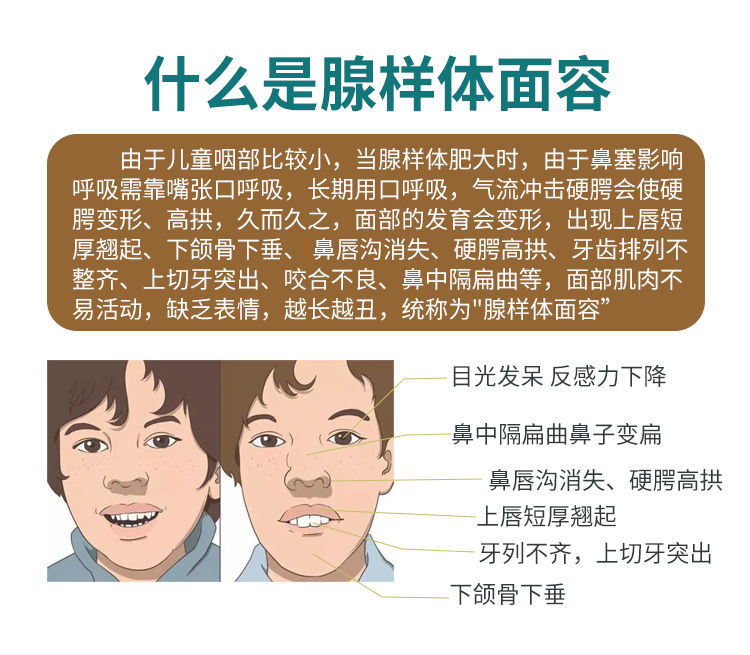 儿童腺样体肥大贴小儿腺样体肿大贴鼻炎鼻塞流涕打呼噜曦康乐鼻贴 3盒