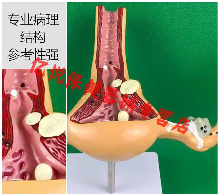 人体子宫模型教具模具卵巢解剖病理医学女性仿真女性生殖模器c款正常