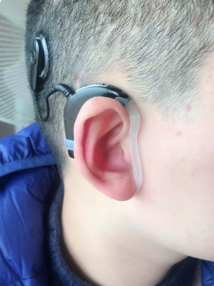 人工耳蜗澳大利亚耳蜗n5n6n7处理器汗套线圈套耳锁n5810透明处理器汗