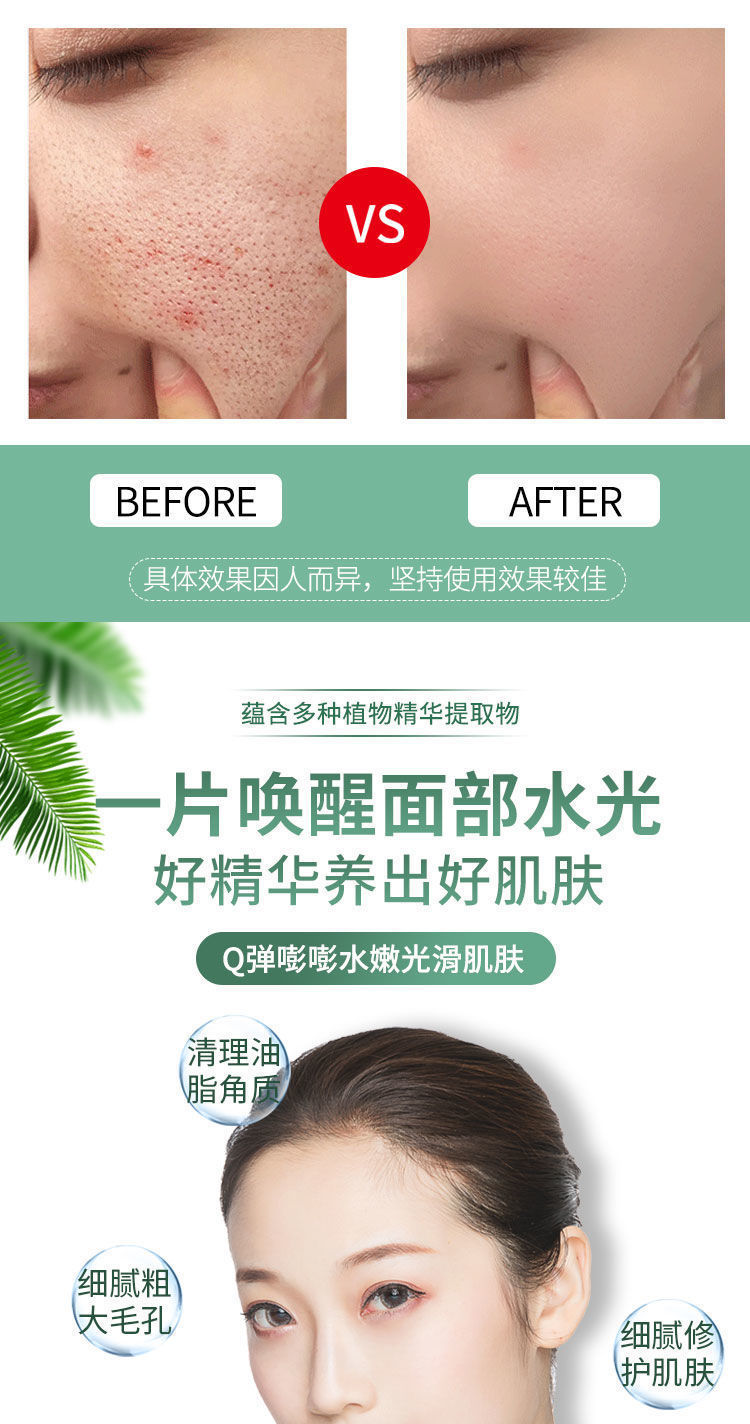 小气泡寡肽面膜抖音同款补水控油去黑头粉刺收缩毛孔深层清洁学生