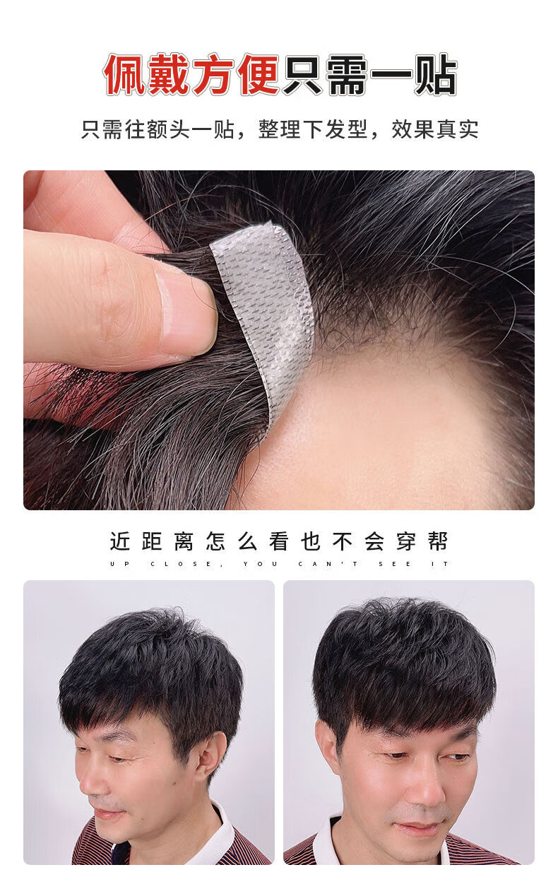 男士发际线假发贴前额补发片全真发秃顶补发逼真隐形无痕m型刘海2516