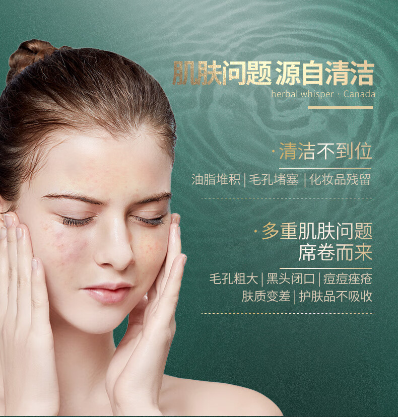 荟诗加拿大冰川泥面膜去黑头粉刺闭口敏感深层清洁毛孔涂抹式泥膜 100