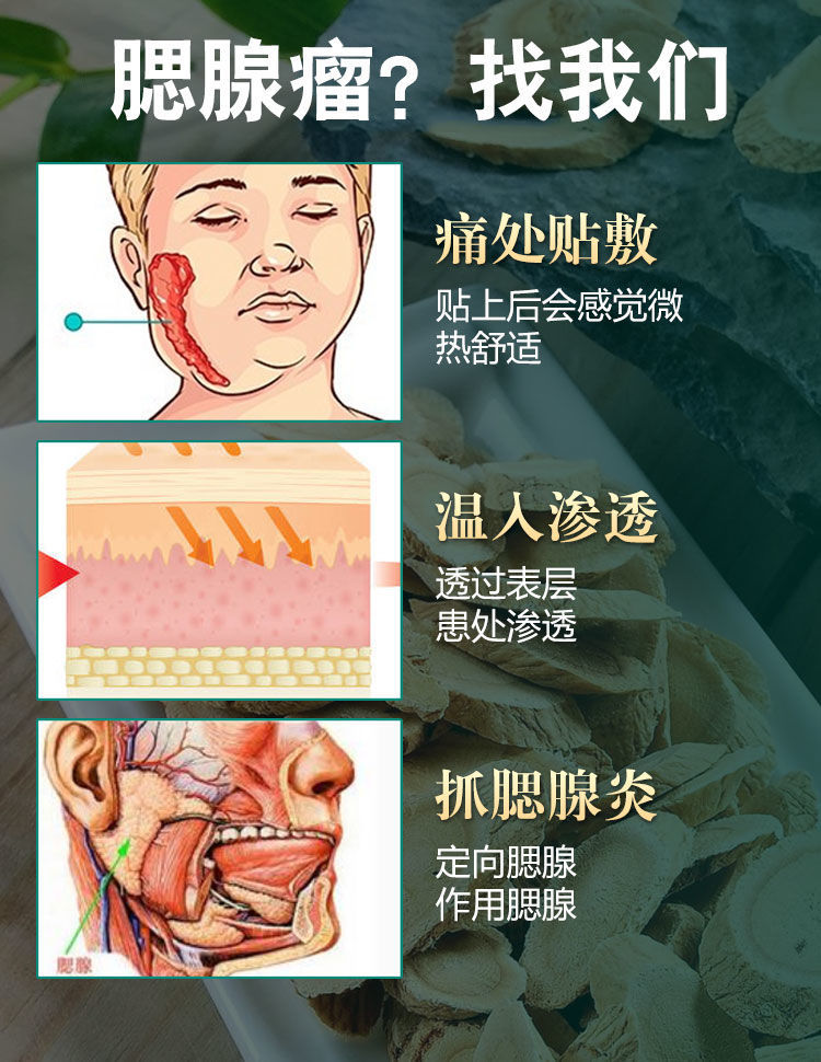 【200%断垠】腮腺炎贴痄腮腺囊肿脸肿吞咽困难肿痛腮腺混合瘤膏贴
