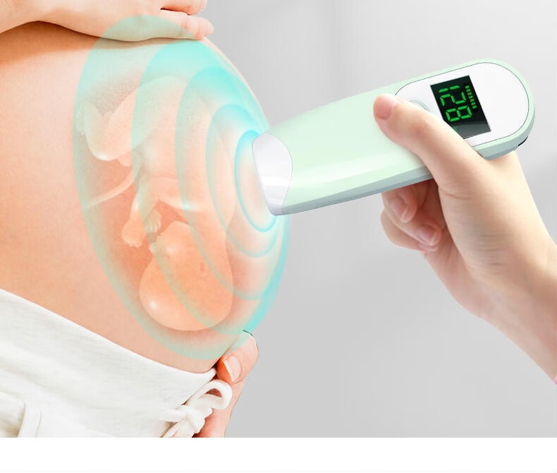 (礼盒装蔷薇粉色)孕橙智能胎心仪【图片 价格 品牌 报价】-京东