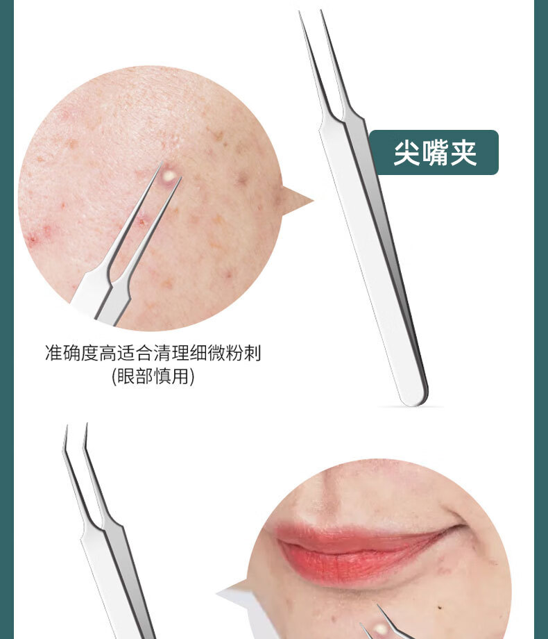 不锈钢粉刺针弯头粉刺夹痘痘镊子挤黑头细胞夹美容暗疮针 塑料盒装粉刺针+斜咀5件套
