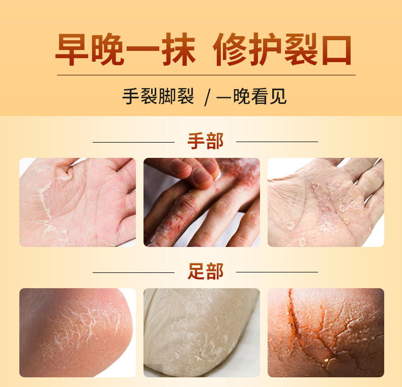 马油膏脚后跟干裂霜护手足防干裂凡士林脚口龟裂脚防裂皲裂膏唯妃美gk