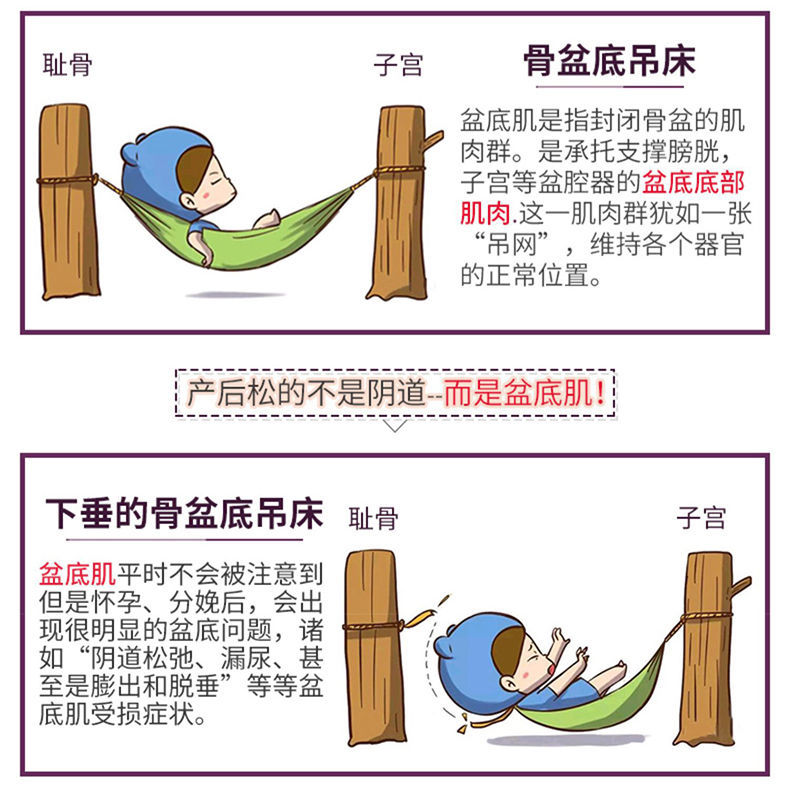 oloey盆底肌修复仪器盆底肌修复仪产后家用美容仪训练盆底肌盆底肌肉