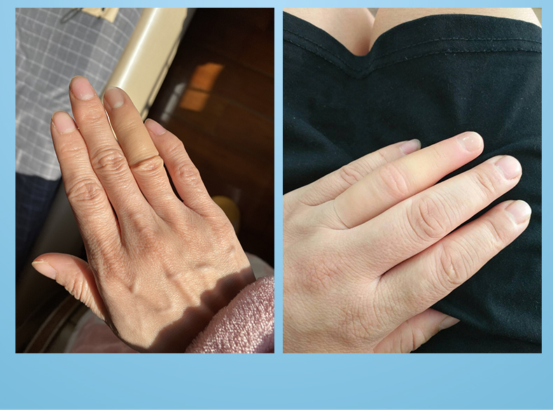 断手指仿真假手指头假肢仿真美容手指指断手指美容手指量身定做假脚趾