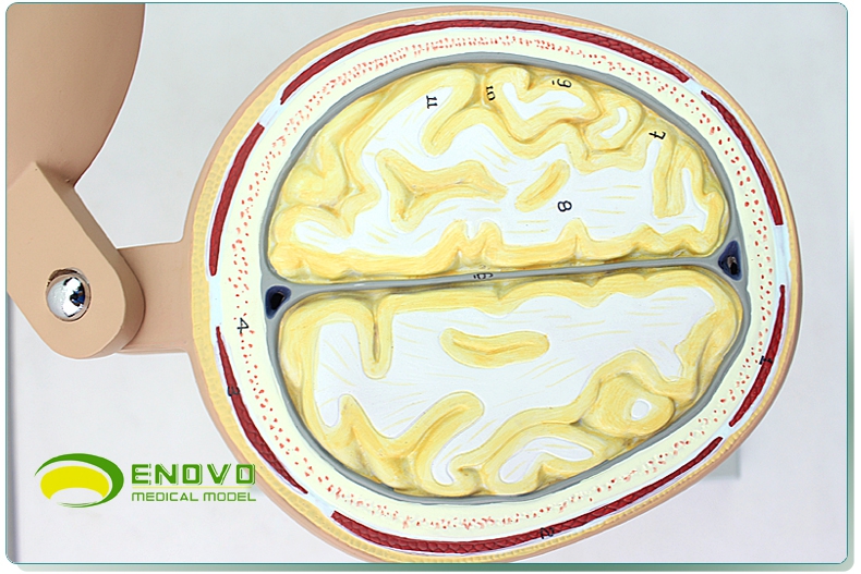 enovo颐诺医学人体头颅脑横切模型大脑模型头颅横切面断层水平切模型
