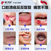 Pengren Pharmaceutical Oral Ulcer Repair Gel is a special medicine for oral ulcers. Children with sores and inflammation of the mouth and tongue can wear Oral Ulcer Patch. Oral Ulcer Powder can be used. Watermelon Cream Oral Ulcer Spray Yidianling