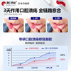 Pengren Pharmaceutical Oral Ulcer Repair Gel is a special medicine for oral ulcers. Children with sores and inflammation of the mouth and tongue can wear Oral Ulcer Patch. Oral Ulcer Powder can be used. Watermelon Cream Oral Ulcer Spray Yidianling
