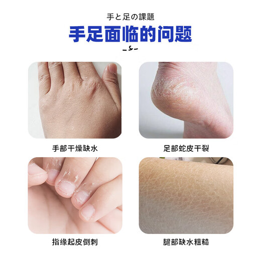 ADULTDINGDING Japan Ding Ding Cracked Cream 50g*1 Heel Cracked Cracked Cracked Foot Cream