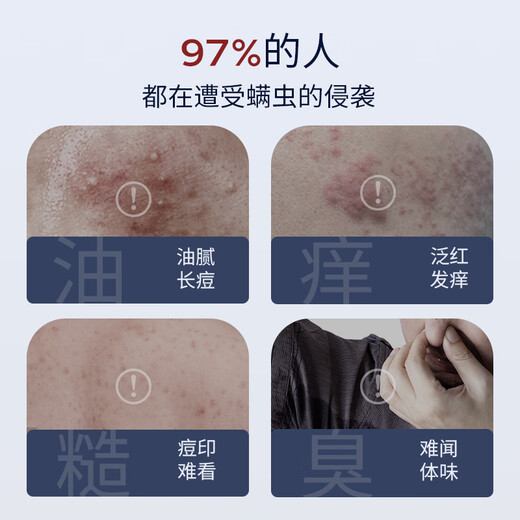 SUMDOY Japan imported fruit acid shower gel to remove mites and remove mites and control oil to relieve itching and moisturizing moisturizing and long-lasting fragrance for men and women [Save 70 yuan immediately] Mite-removing shower gel *2
