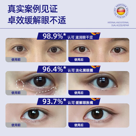 沃朗森医用蒸汽眼罩热敷护眼贴缓解眼疲劳改善视力模糊眼干眼涩睡眠专用