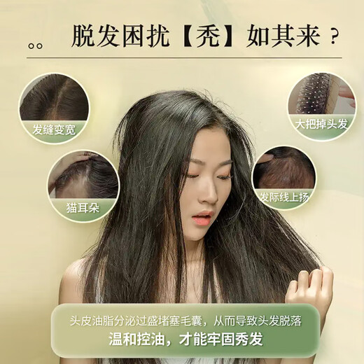 Yangyuanqing Shampoo Yunnan Baiyao Ölkontrolle Anti-Scalp-Pflege Shampoo Dunhuang Ölkontrolle Gesundheit 210ml*4
