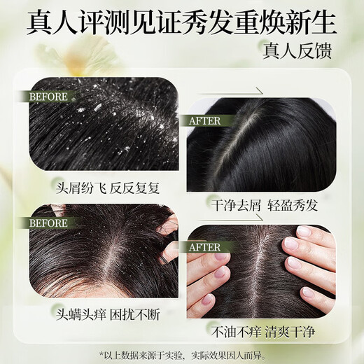 Bawang Shampoo Anti-dandruff, anti-itch and oil-control shampoo 1000ml (fresh and refreshing anti-dandruff, anti-itch and oil-control shampoo)
