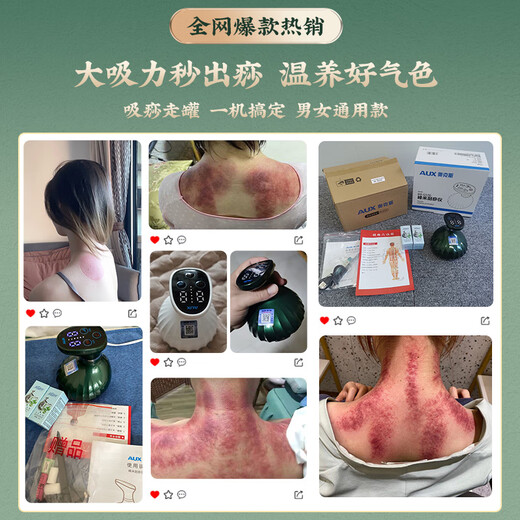 AUX scraping instrument electric cupping household scraping board brush artifact negative pressure cupping instrument meridians to remove dampness and dredge the whole body summer health care gifts for the elderly and parents practical flagship model emerald green top with charging gifts for parents, parents, elderly family members, elders, wife's day birthday gifts
