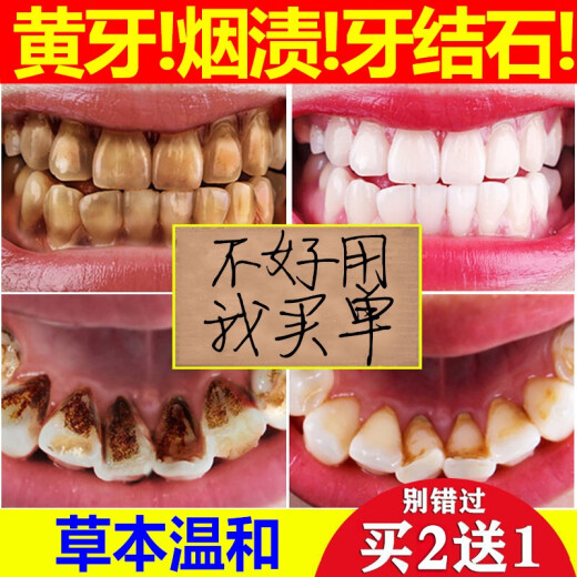 [Bye bye yellow teeth] Tooth cleaning powder, tooth cleaning powder, beautiful teeth, white teeth, brushing powder, remove yellow teeth, smokers smoke tartar, tartar, bad breath, smoke stains, tooth stains, pearl brightening teeth whitening artifact, Miao Jinhua single box [please take 2 photos for serious cases], box]