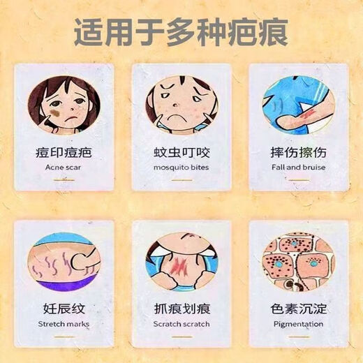 SUBEX Scar Cream German original German SUBEX scar removal cream German SUBEX German version SUBEX sunken body care 30g*1 piece German SUBEX Contractubex German original-non-Hong Kong version