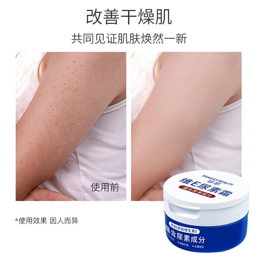 Qingling Vitamin E Urea Cream Skin Care Cream Full Body Moisturizing Skin Anti-Drying Vitamin E Cream Ointment Vaseline Vitamin E Cream Vitamin E Urea Cream 3 Boxes (Family Pack)