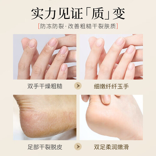 Yunnan Materia Medica Hand and Foot Peeling Antibacterial Cream Seasonal Hand Peeling Finger Palms Sloughing, Cracking, Cracking, Skin Blistering Fungal Infection Hand and Foot Peeling Cream 20g One bottle sent 1 bottle/box