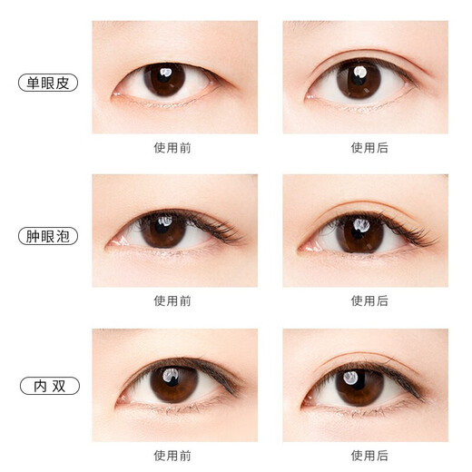 Unny club's double eyelid stickers for women are naturally invisible and traceless to enlarge the eyes. The stickiness lasts for a long time and is light and thin. Simulated lace. L length and width type - 90 pieces