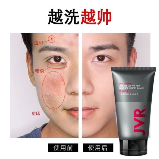 Jewel men's special facial cleanser oil control oil removal cleansing cream student deep cleansing pores moisturizing skin care products volcanic mud acne removal blackhead facial cleanser 100g