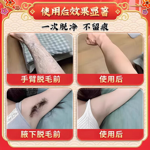 Lan Yanzhi hair removal cream for men and women, permanent root removal for private parts, no longer growing, medical limbs, armpits, beard and beard hair removal, special effect hair removal cream 1 box