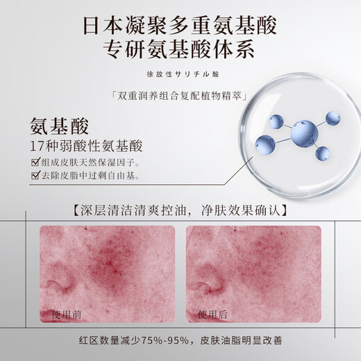 Bayer (BAYER) Ten Billion Patch Eleytele Japan imported men's facial cleanser amino acid oil control cleanser deep cleansing 200 200g