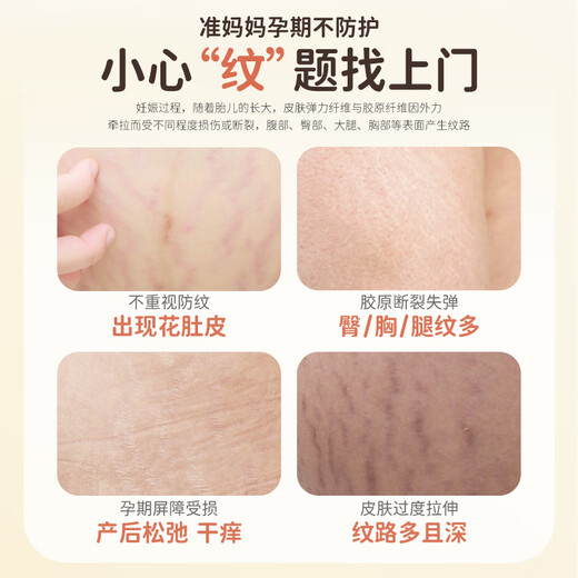 Masata Singapore imported pregnancy oil for pregnant women to prevent stretch marks, dilute and repair olive oil body massage oil to prevent stretch marks during pregnancy丨120ml