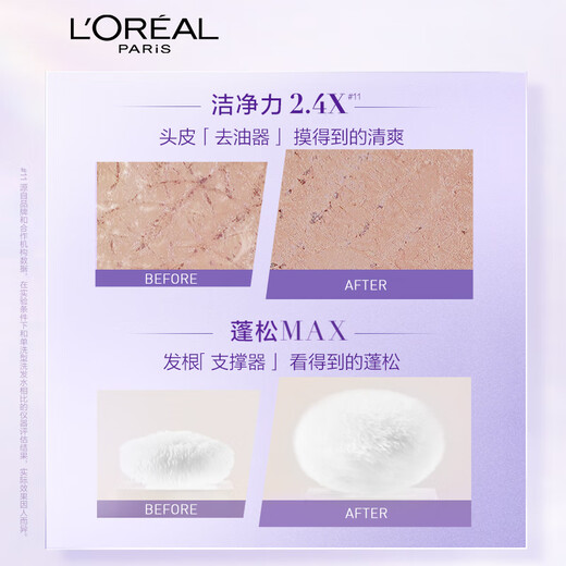 L'Oreal Hyaluronsäure erfrischende Ölkontrolle Flauschiger Trüffel Shampoo 100ml (Shashmoke Travel Package)