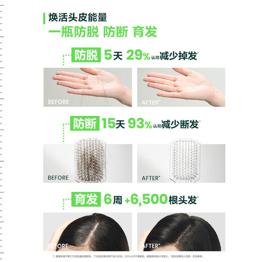 Fulvdeya newly upgraded white beads shampoo 500ml anti-hair loss, solid growth and fluffy hair imported from France