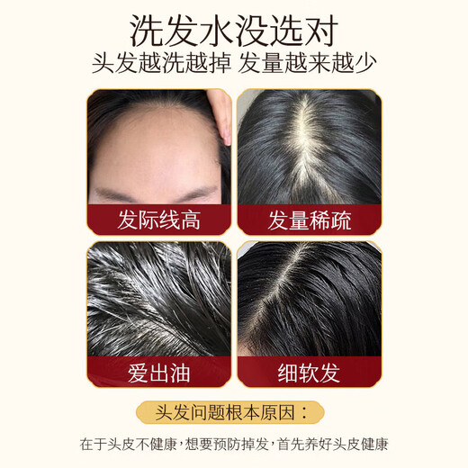 Gaotiya Anti-Deletion Hair Dermatology Champú Ginger Cabello sólido Aceite de aceite esponjoso Roots y cabello Strong Shampoo 500ml