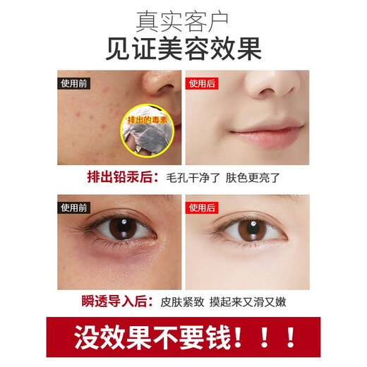 VLVEE Ultrasonic Beauty Instrument Export and Import Instrument Beauty Salon Special Instrument Facial Lifting Firming Facial Massage Oxygen Injection Hydration Instrument Pore Cleaning Household Cherry Blossom Powder/Ultrasonic Upgrade Model Qingji Capsule