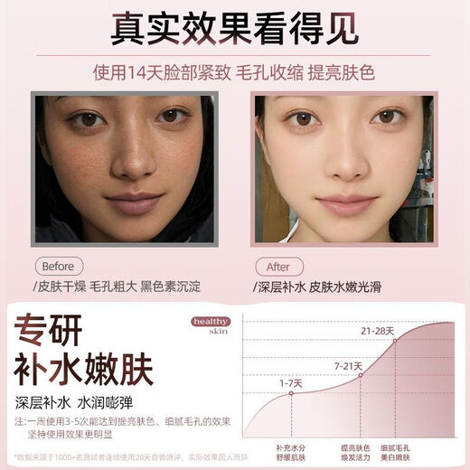 Xia Xin Facial Steamer Nano Hydrating Sprayer Household Steam Machine Beauty Salon Special Facial Humidification Facial Steamer Sakura Powder Xia Xin Quality Assurance Exclusive Edition - Medical Beauty* Large Spray + Deep Cleansing + Moisturizing and Rejuvenating