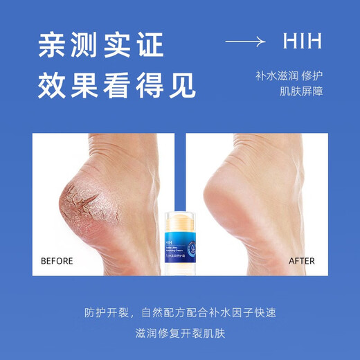 HIH 2-pack Vaseline Anti-Cracking Cream for Hands, Feet, and Cracks Cream for Hands, Feet, and Heels to Remove Peeling and Cracks 35g Peach Anti-Cracking Cream for Hands, Feet, and Heels 35g