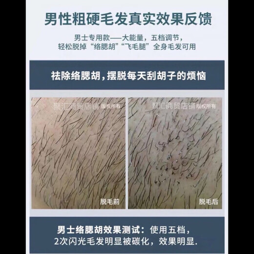 Household hair removal instrument for men, beard removal, beard removal, laser freezing point hair removal instrument for men, painless whole body beauty salon, women with sweaty lips, chest and leg hair, enhanced version white (high power, can be used all over the body with beards)