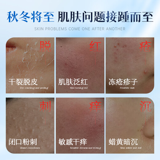 Ruyi (RUYI) B5 Men's Toner 500ml Moisturizing and Moisturizing Water Contract Pores and Removing Yellowness Stay Up and Skin Care Water
