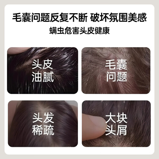 馥珮毛囊清洁二硫化硒洗发水去屑止痒洗发露除螨洗头膏男女士蓬松