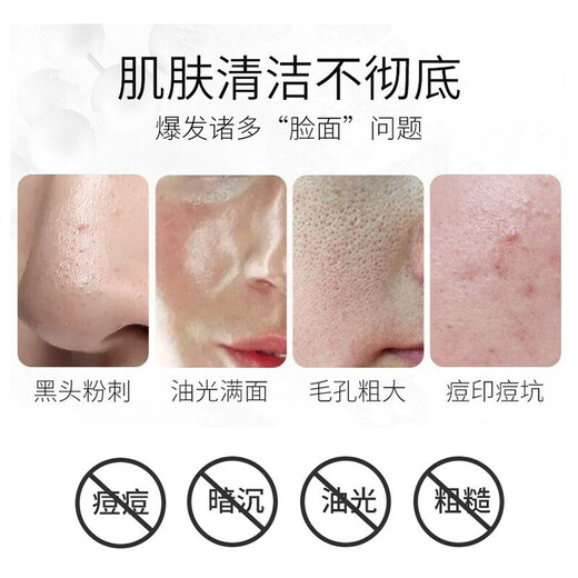 Nanjing Tongrentang Aminosäuren-Öl zur Kontrolle von Akne-Gesichtsreiniger, Milben entfernen, Mitesser und Akneflecken entfernen, Poren verkleinern, feuchtigkeitsspendender Gesichtsreiniger für männliche und weibliche Studenten, Aminosäure-Gesichtsreiniger, 200 ml, 1 Flasche, Probepackung