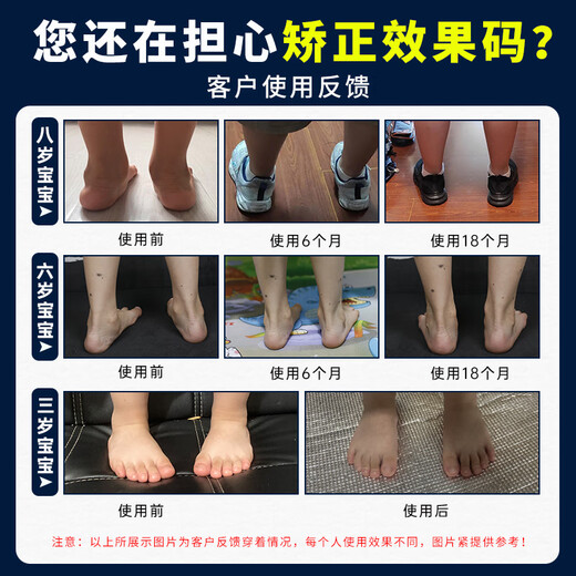 Luozaizai children's flat foot corrective functional shoes, foot valgus sandals, XO-type leg internal and external splay support arch insoles for babies, pink, correction/flat foot + foot valgus, size 23 (suitable for foot length 14cm/inner length 15cm)