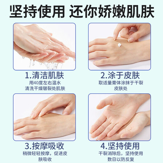 New Xile Cracking King 88g Cracking Ning Vaseline Anti-Cracked Hand Cream Heel Non-Frostbite Hands and Feet Freeze-Cracked Cream