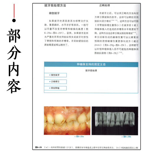 【自营优质】 口腔固定修复中的美学重建 第1卷 主译王新知 辽宁科学技术9787559116864 16864