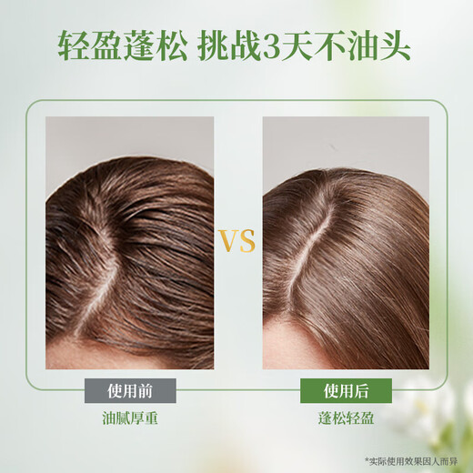 阿道夫洗发水去屑止痒控油蓬松清爽柔顺洗发乳男女士洗头膏 澳谷-祛油清爽洗发水 260ml*1瓶