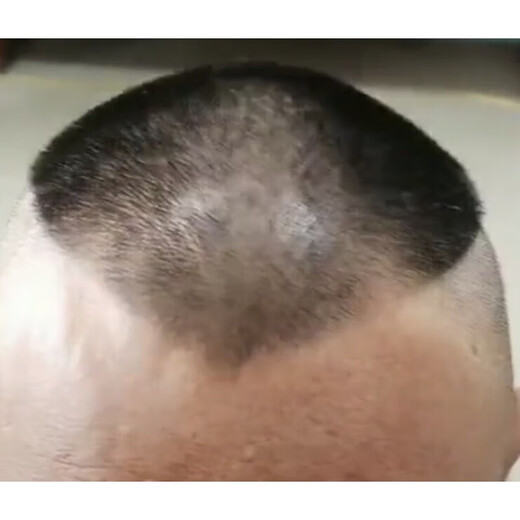 Jin Jinyangs eigenes Haarschnitt Haarschimmel Guo Degangs Erwachsener Frisur Guo Degangs Pfirsich Herz Kurzhaar -Rasierassistent Guo Degang 1416 cm